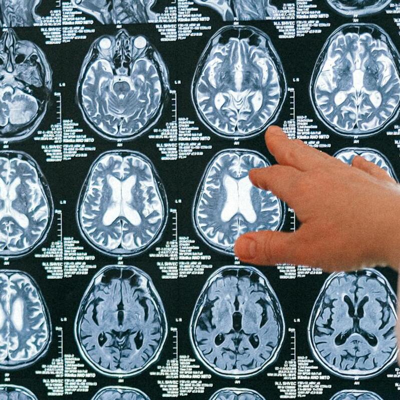  Imagen Estudio revela diferencias cerebrales en personas con rasgos psicopáticos y conductas antisociales noticia