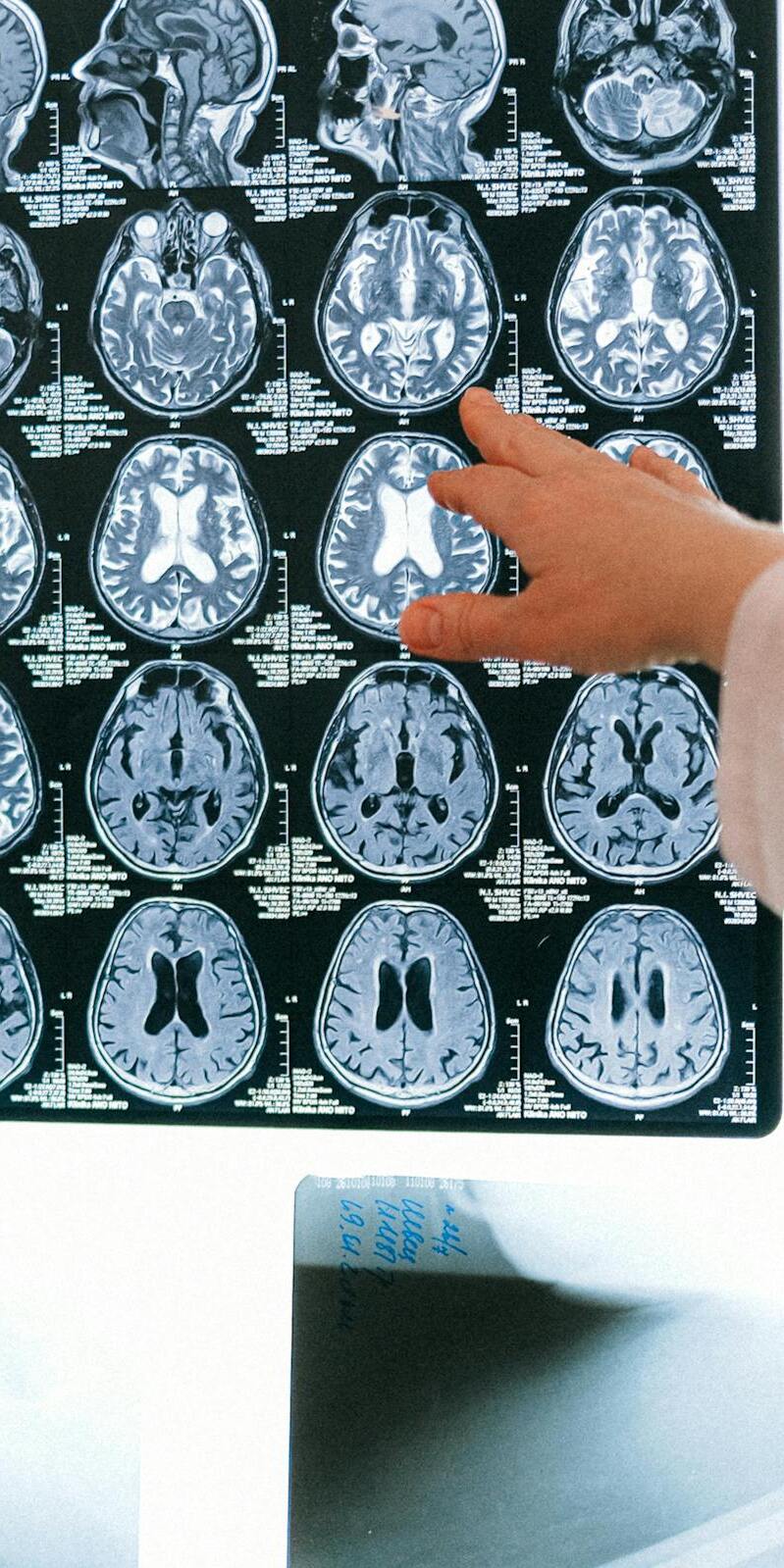  Imagen Estudio revela diferencias cerebrales en personas con rasgos psicopáticos y conductas antisociales noticia
