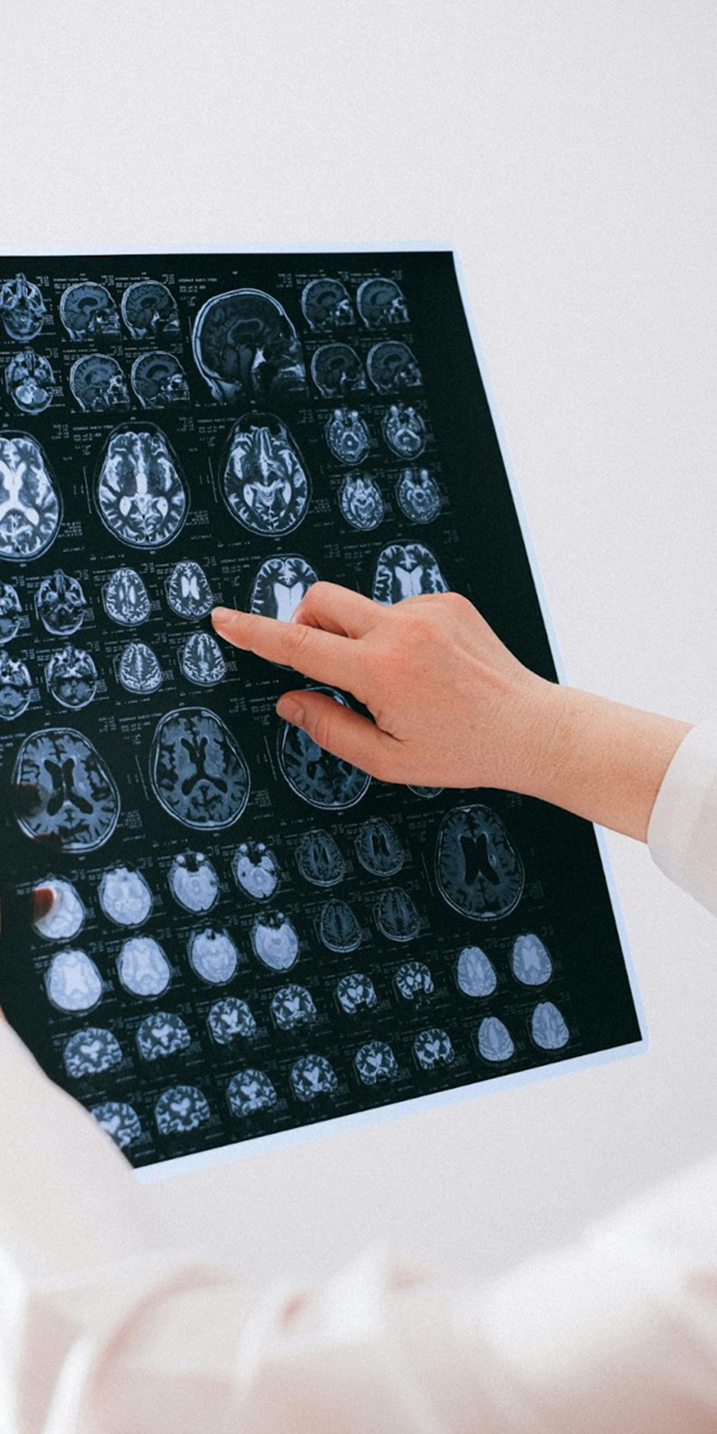  Imagen Investigación revela un importante descubrimiento en la comunicación del eje intestino-cerebro noticia